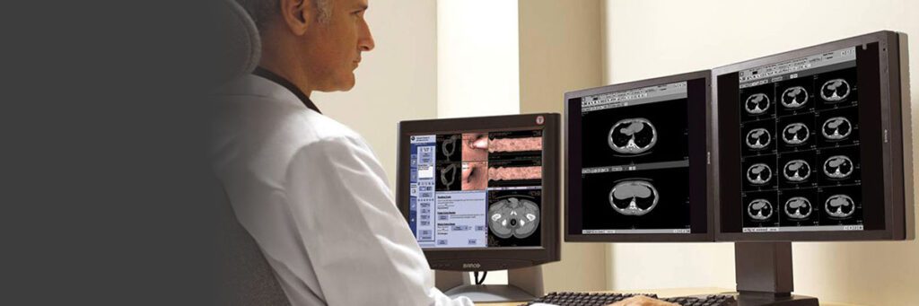 Mammography Workstations