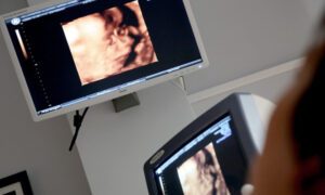 Ultrasound