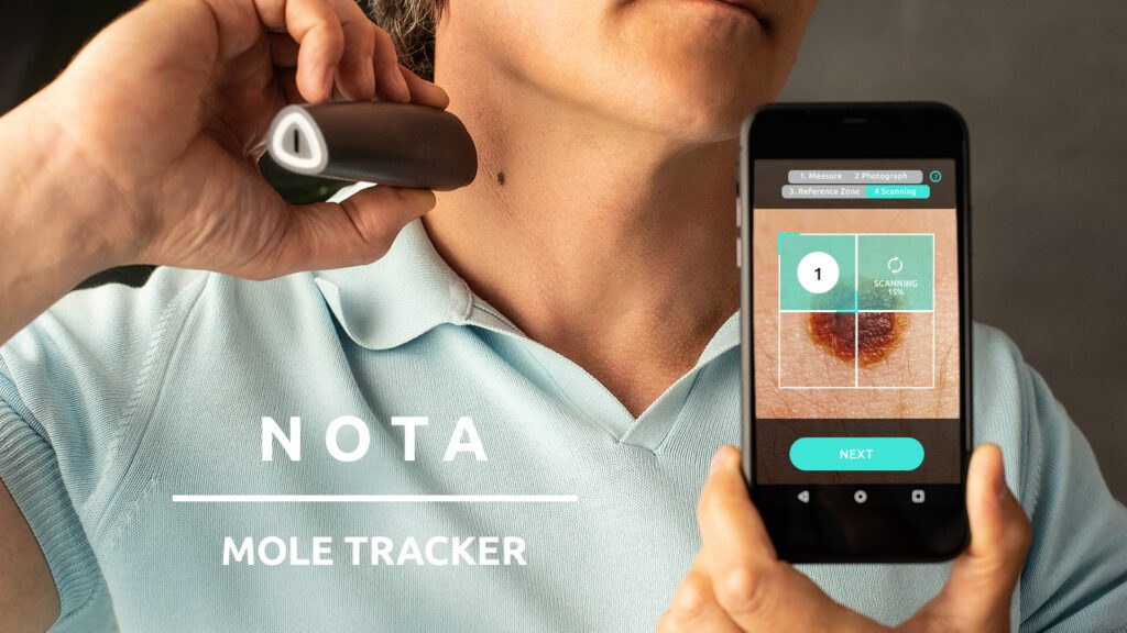 NOTA Bioimpedance Technology