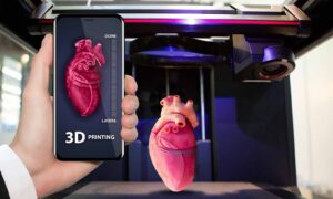3D Printing Healthcare