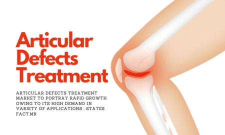 Articular Defects Treatment