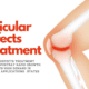 Articular Defects Treatment