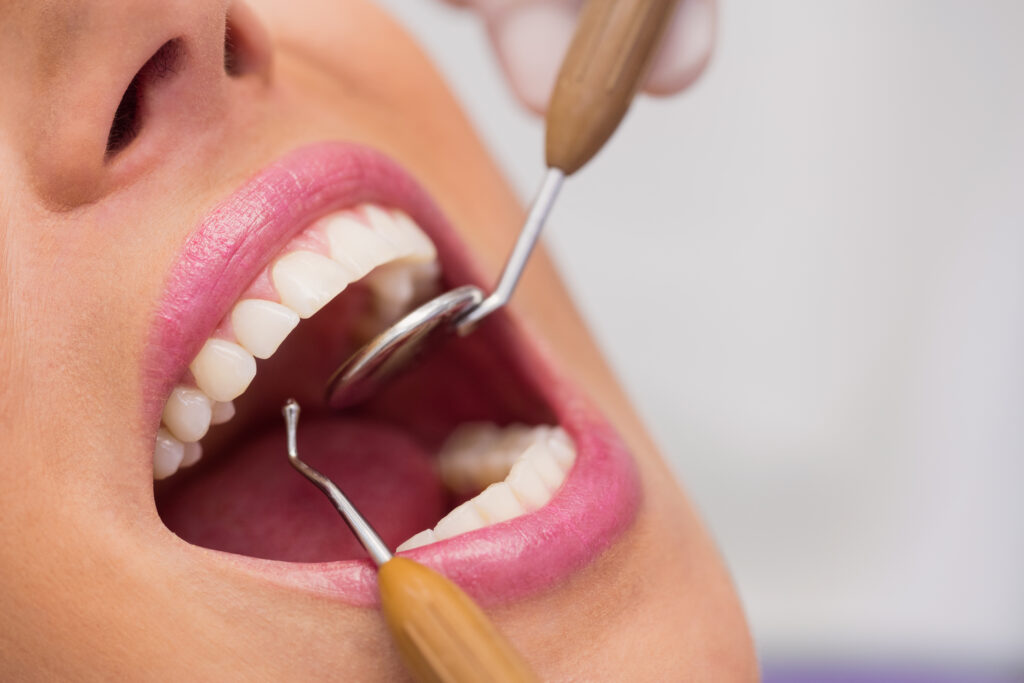 Oral Hygiene Market