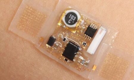 Electronic Skin Patches Market