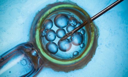 Assisted Reproductive Technology