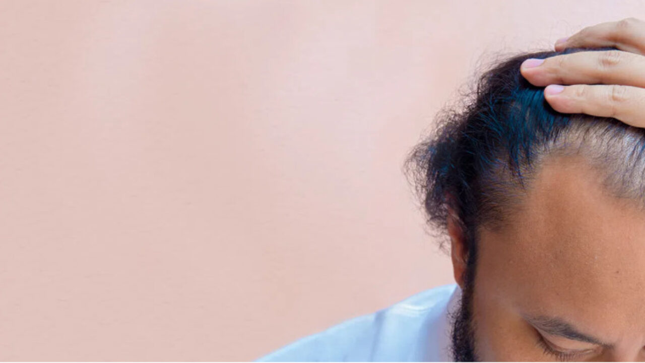 Why is Hair Fall Major Issue for Men? And What Are Its Types - TechBullion