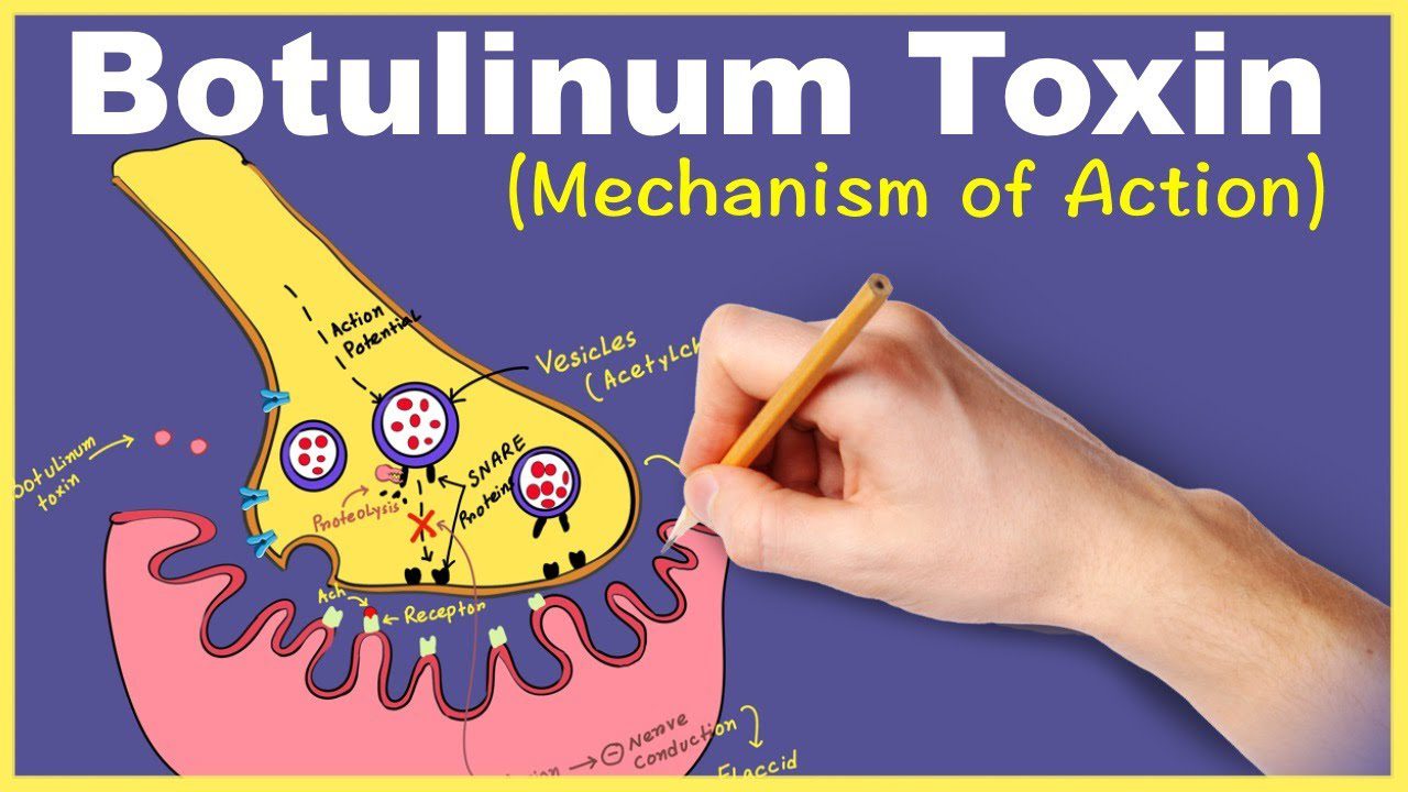 botulinum