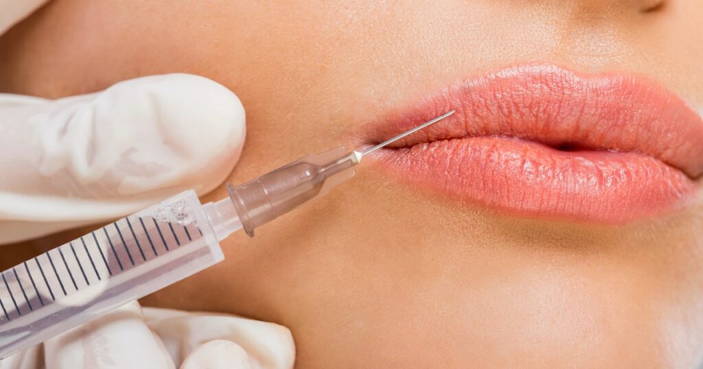 Lip Injections