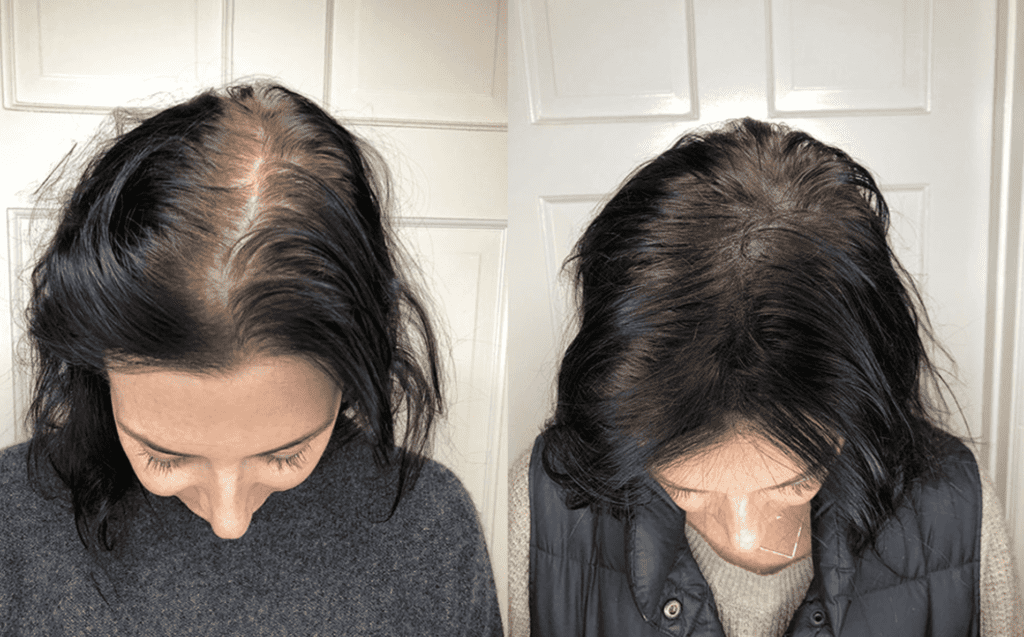 Hair Tattoo