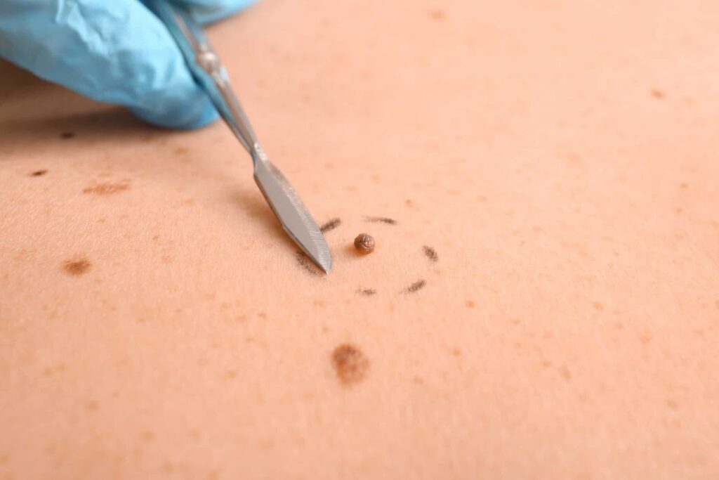 Reclaiming Precisions: Why Cosmetic and Laser Treatments are Worth Considering in Perth
