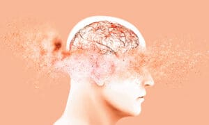 Dementia Care