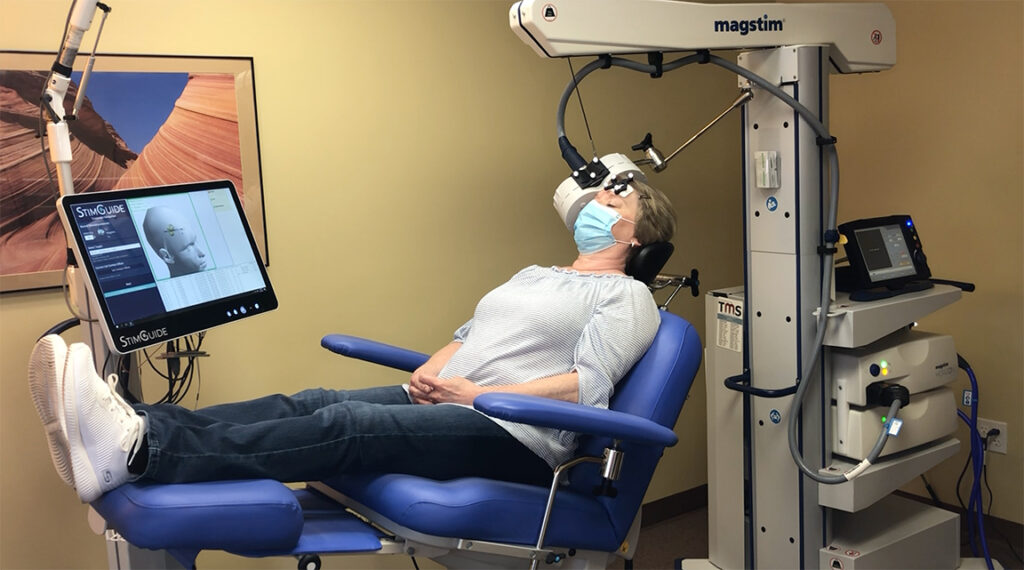 TMS Therapy