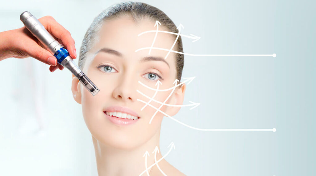 The Science Behind Microneedling And Glowing Skin