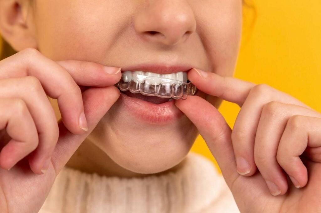 The Psychology of Teeth Grinding: Understanding the Emotional Factors