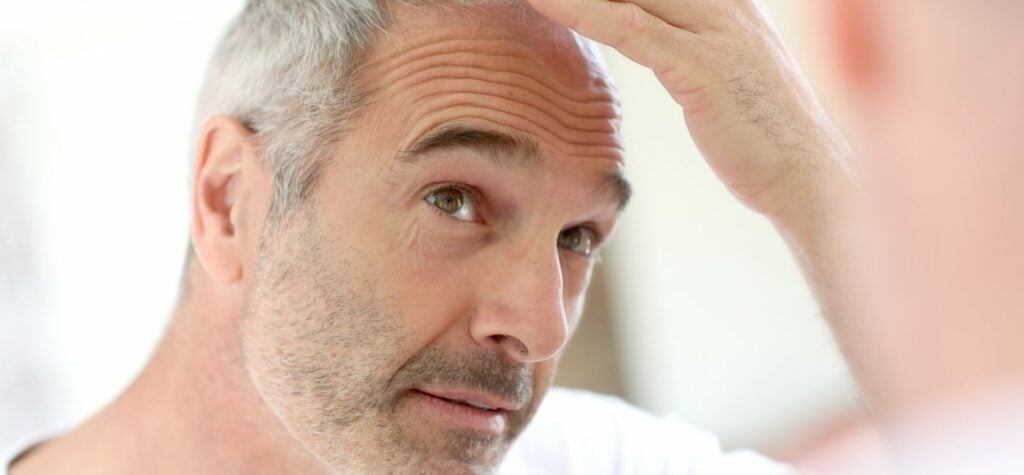 London's Hair Transplant Pioneers: Shaping New Beginnings