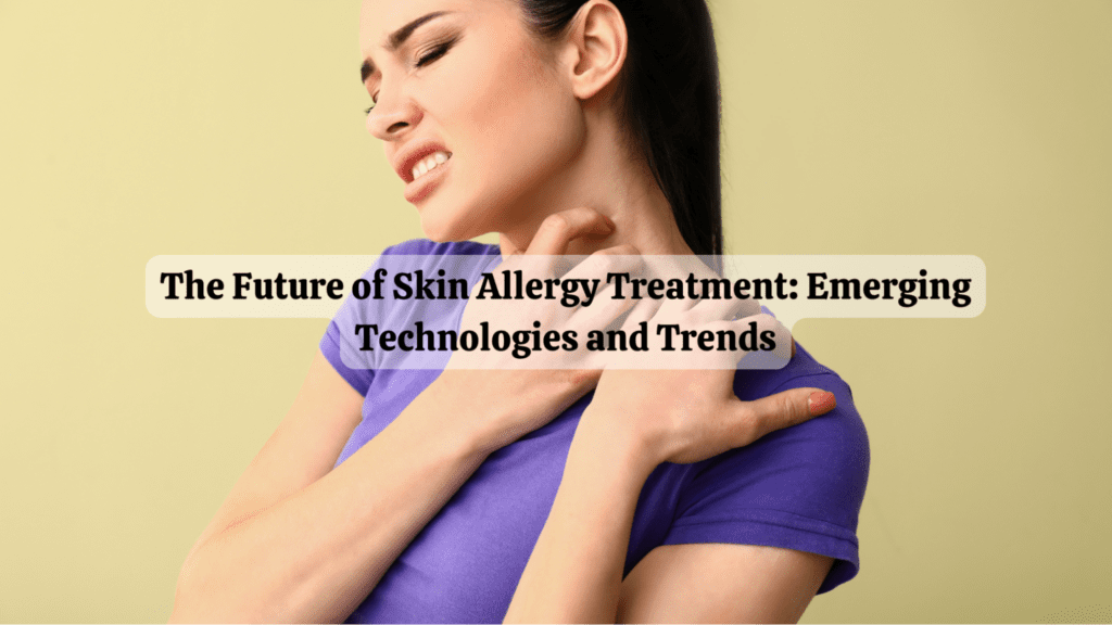Skin Allergy Treatment
