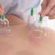 Unfolding the Mysteries: What to Expect During Your First Cupping Therapy Session