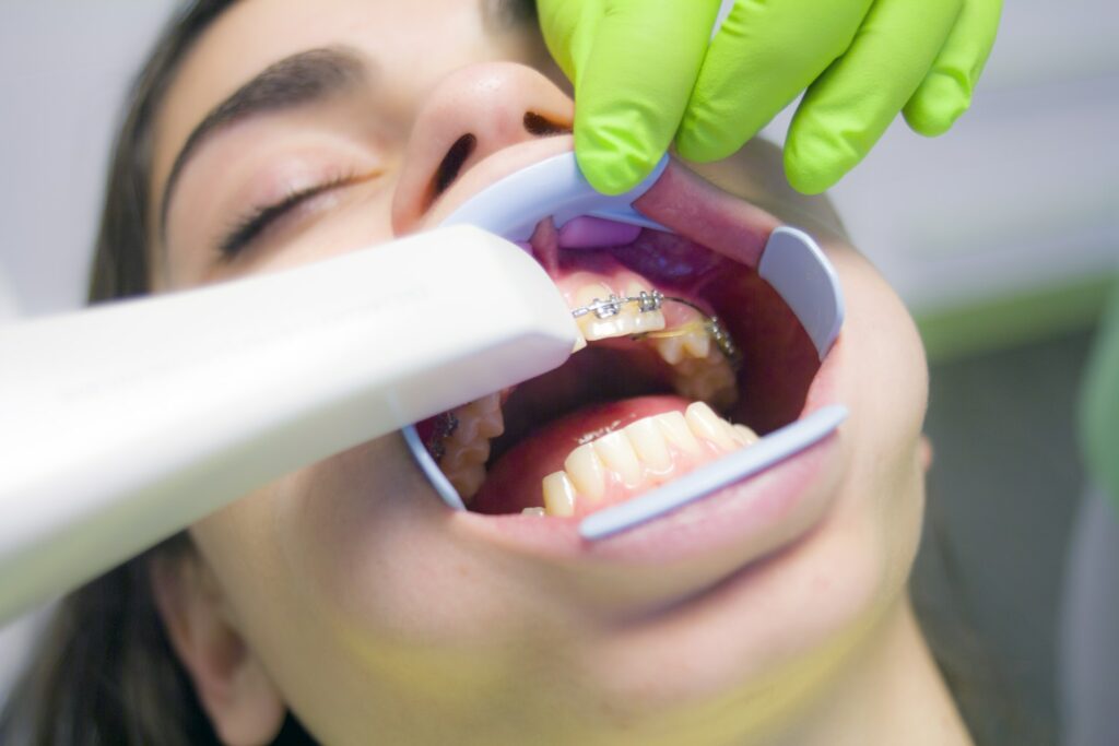 Dental