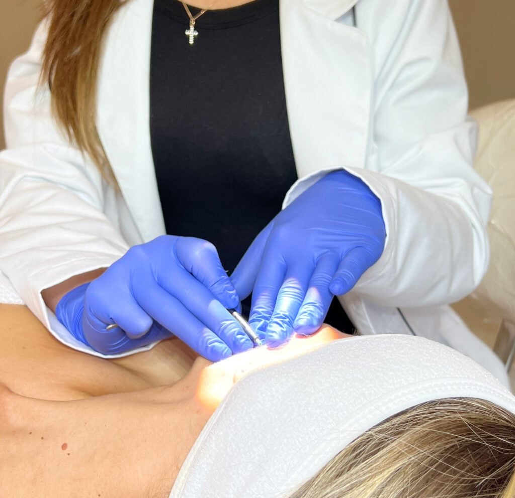 What Can Go Wrong with Electrolysis Hair Removal?