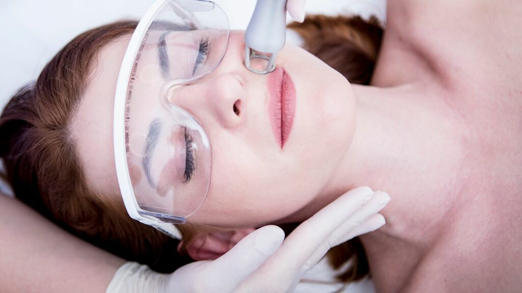Skin Resurfacing