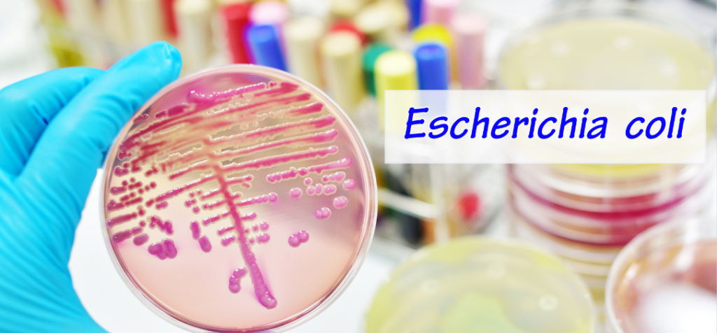 Preventing E. Coli Infections