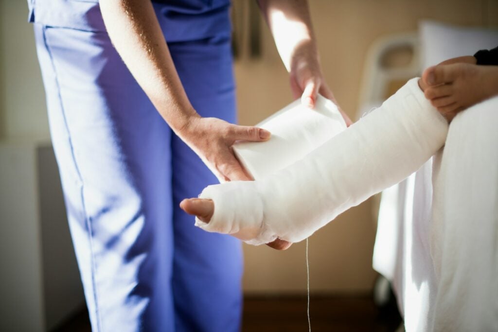 cast on arm