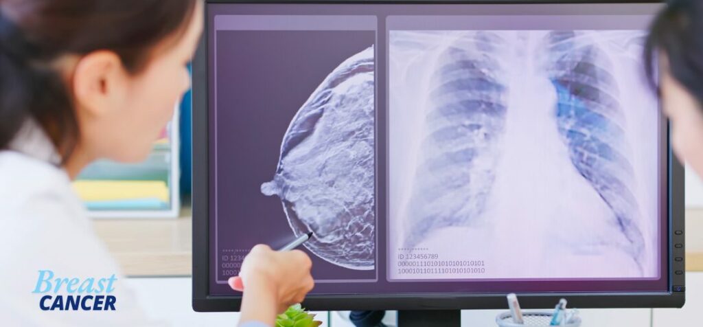 Breast Cancer Detection and Treatment AI