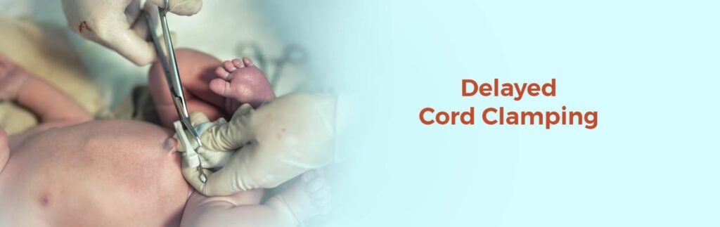 Top 5 Benefits of Delayed Cord Clamping