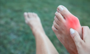 Bunion Pain?