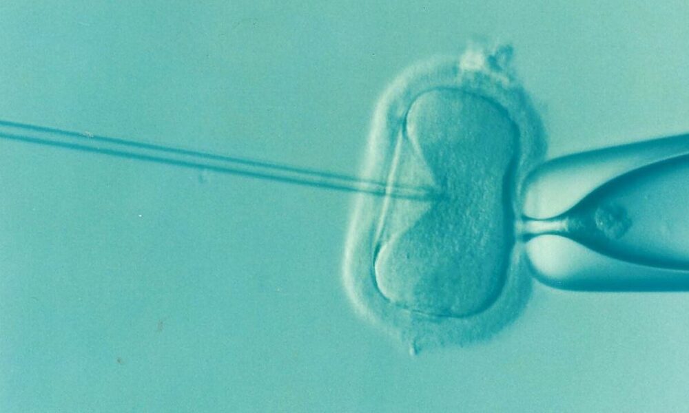 IVF Add-Ons: Separating the Evidence from the Hype
