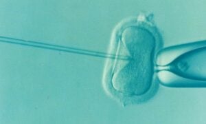 IVF Add-Ons: Separating