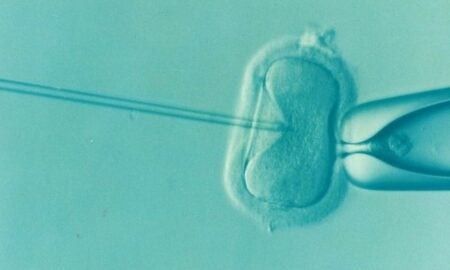 IVF Add-Ons: Separating