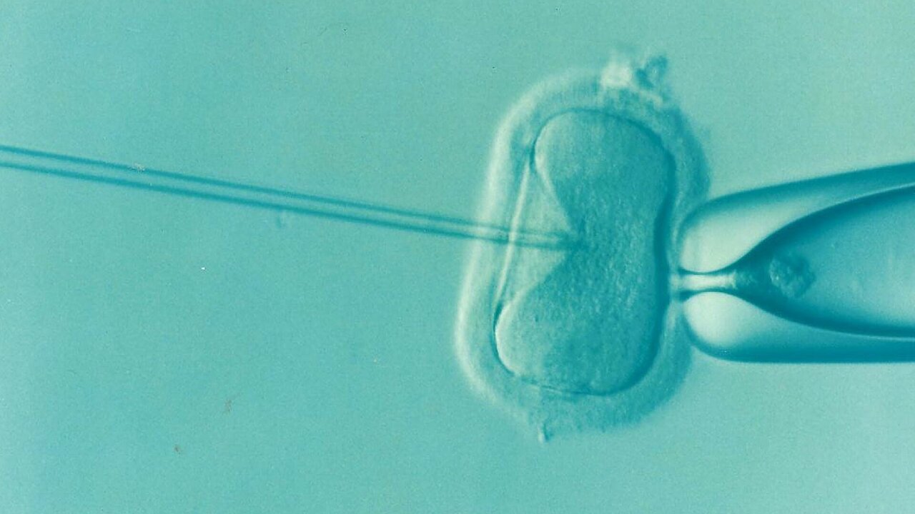 IVF Add-Ons: Separating