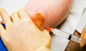 Long Do Injectable Steroids