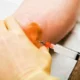 Long Do Injectable Steroids