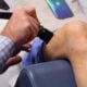 Shockwave for Chronic Pain