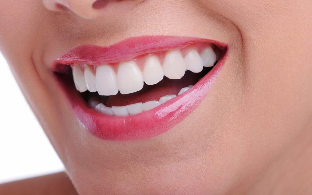 Dental Whitening Treatment