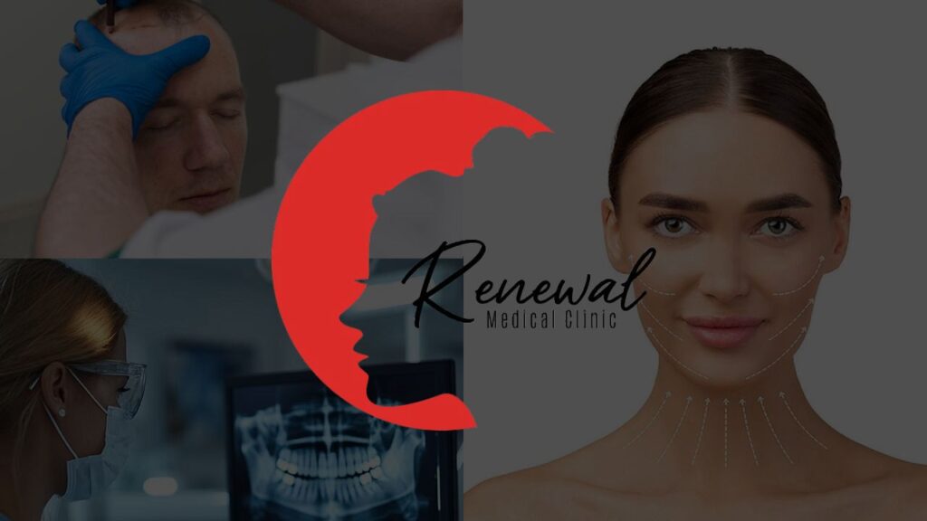Renewal Medical Clinic Hair Transplant