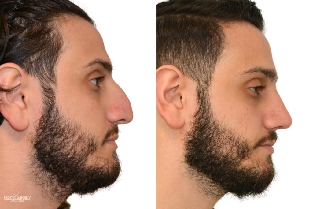 NYC Surgeon