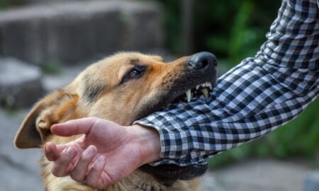 Dog Bite Incident in Detroit