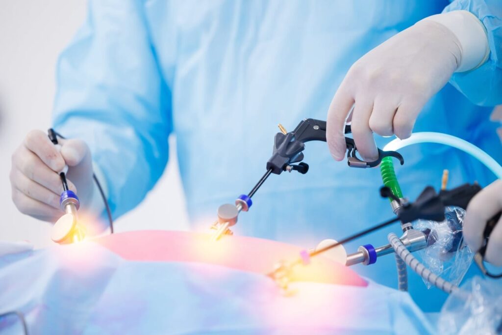 Laparoscopic Surgery Training