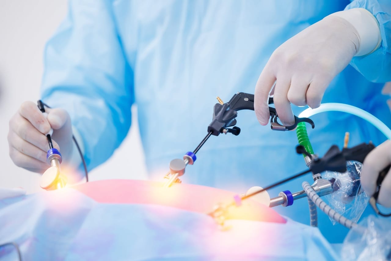 From Scalpel to Screen: Why Laparoscopic Surgery Training Is Essential for Modern Surgeons