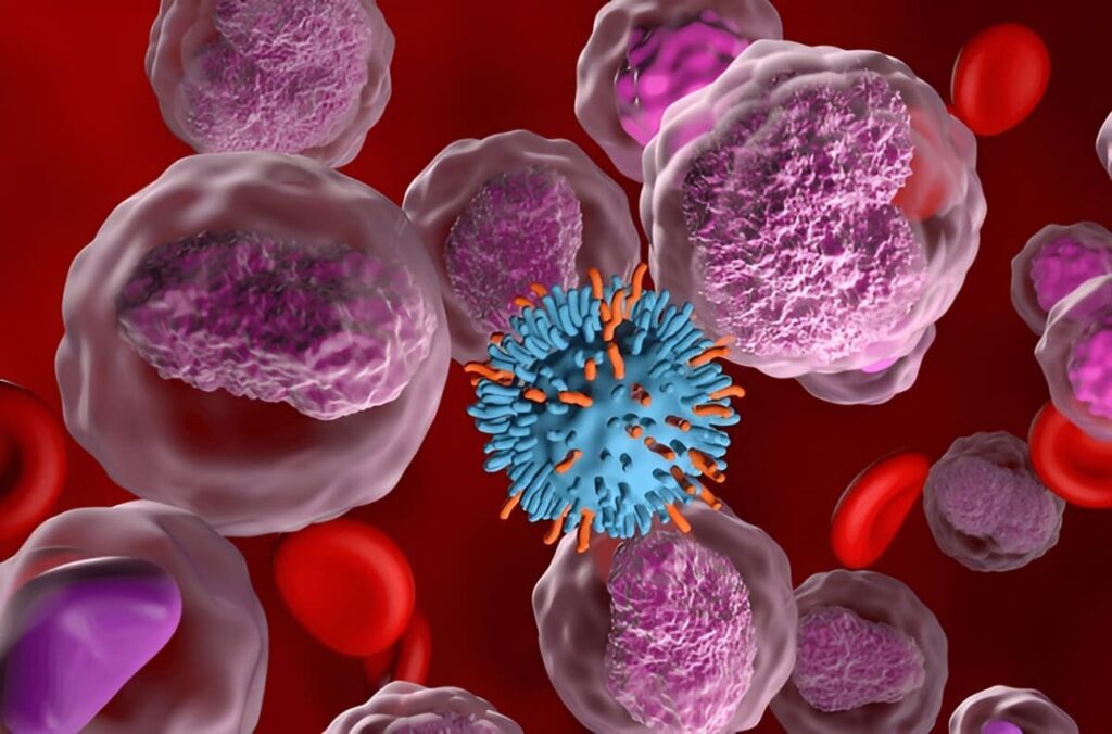 Stem Cell Lymphoma Treatment and Procedures: A Comprehensive Guide