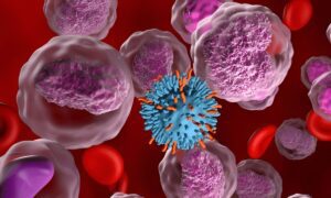 Stem Cell Lymphoma Treatment and Procedures: A Comprehensive Guide