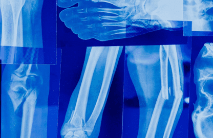 How Technology Is Advancing Medical Imaging Services