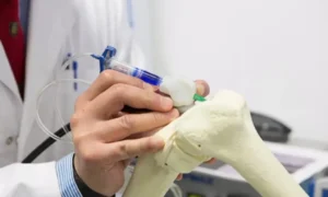 Stem Cell Lymphoma Diagnosis and Evaluation: Understanding the Process