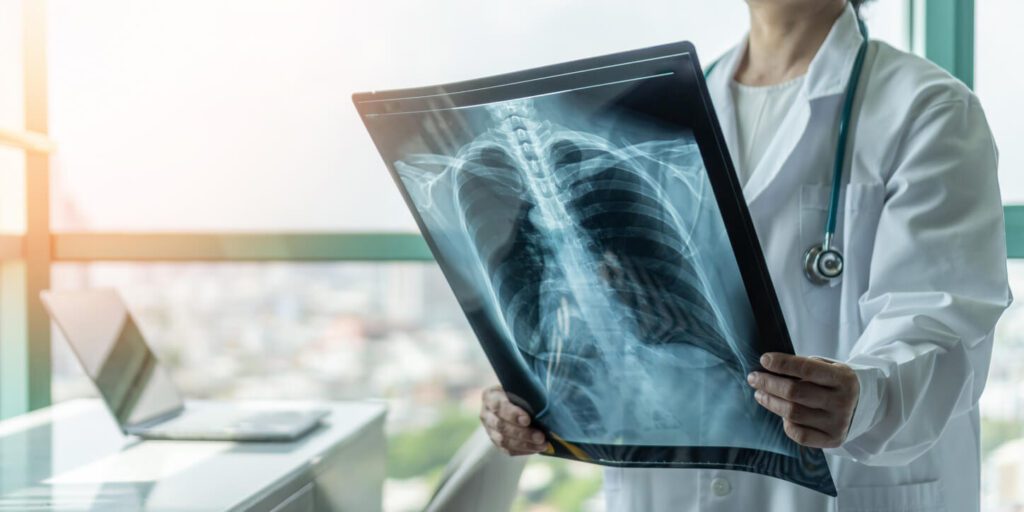 X-Ray Imaging