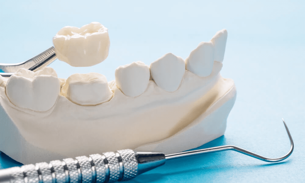 Fixed Prosthodontics: Technology, Trends & Modern Dental Labs