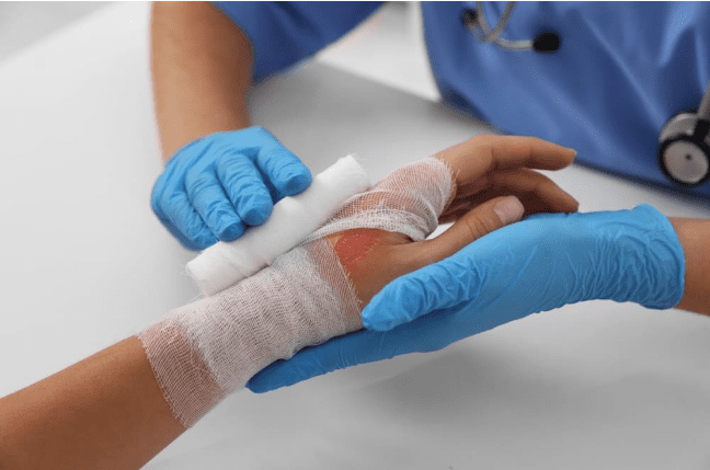 Severe Burn Injury Settlement: How to Maximize Compensation in a Personal Injury Claim