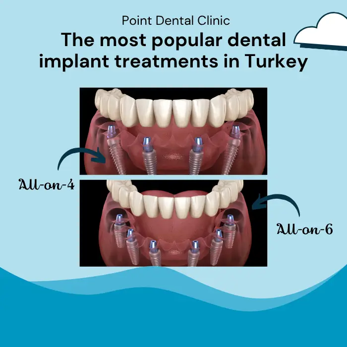 Combine Your Holiday with Implant Treatment in Turkey at Point Clinic